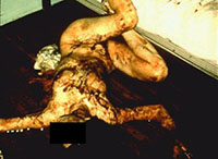 Exhibit 2: Slashed teenage girl a victim of consumer culture.